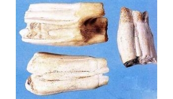 龙齿 青龙齿、白龙齿