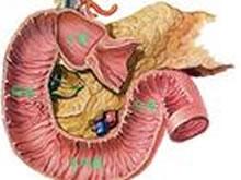 肠系膜上动脉压迫综合征