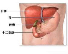 胆囊-结肠肝曲粘连综合征