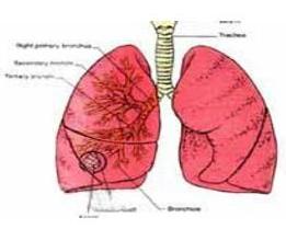 肺囊性纤维化