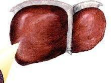 肝脏局灶性结节性增生