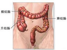 结肠脂肪瘤