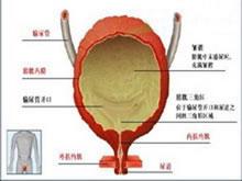 巨膀胱-小结肠-肠蠕动不良综合征