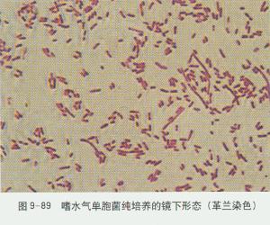 嗜水气单胞菌感染