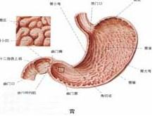 胃神经纤维瘤
