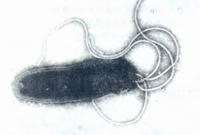 幽门螺杆菌感染