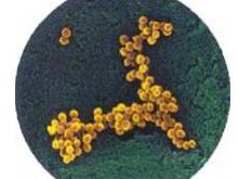 金黄色葡萄球菌肺炎