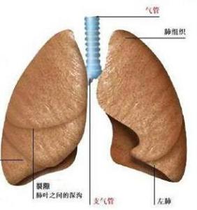 棉尘肺