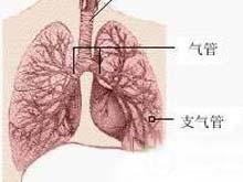 迁延性肺嗜酸粒细胞浸润症