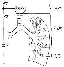 吸入性损伤矽肺