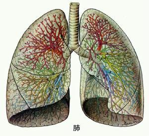 锡尘肺细菌感染性肺炎