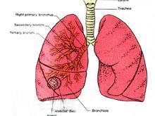 哮喘性肺嗜酸粒细胞浸润症