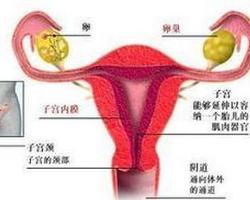 女性生殖道多部位原发癌