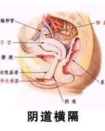 阴道横隔阴道横纹肌肉瘤