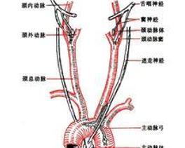 颈动脉窦综合征
