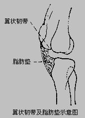 膝关节创伤性滑膜炎