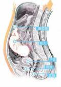 分娩腹腔妊娠